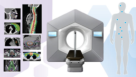 Mise en place technique 2